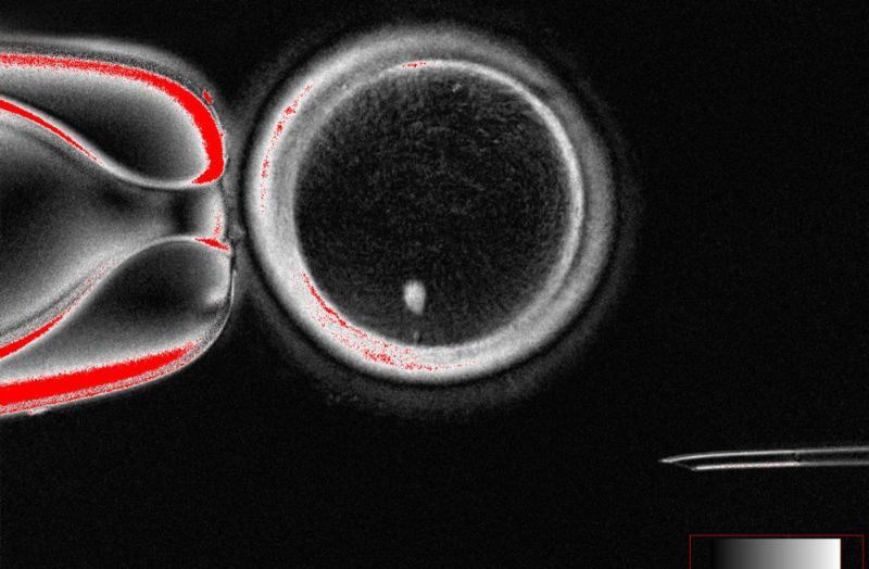Ученые создают эффективные яйцеклетки из кожи человека — прорыв в лечении бесплодия