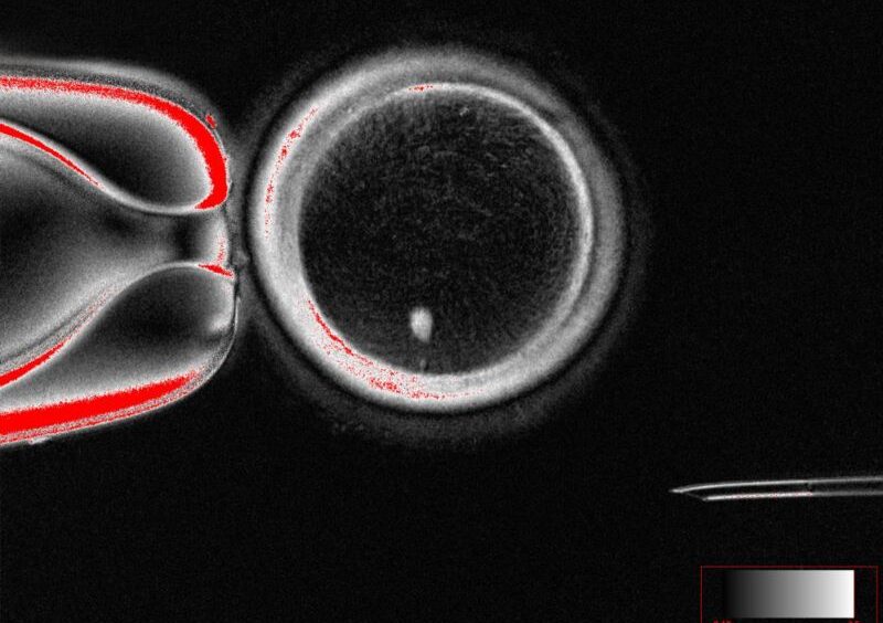 Ученые создают эффективные яйцеклетки из кожи человека — прорыв в лечении бесплодия