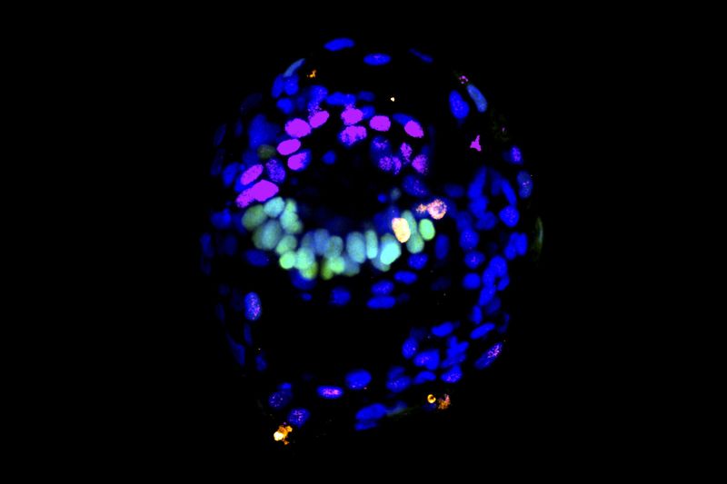 Lab-grown embryo models are getting more realistic. Scientists are getting more concerned